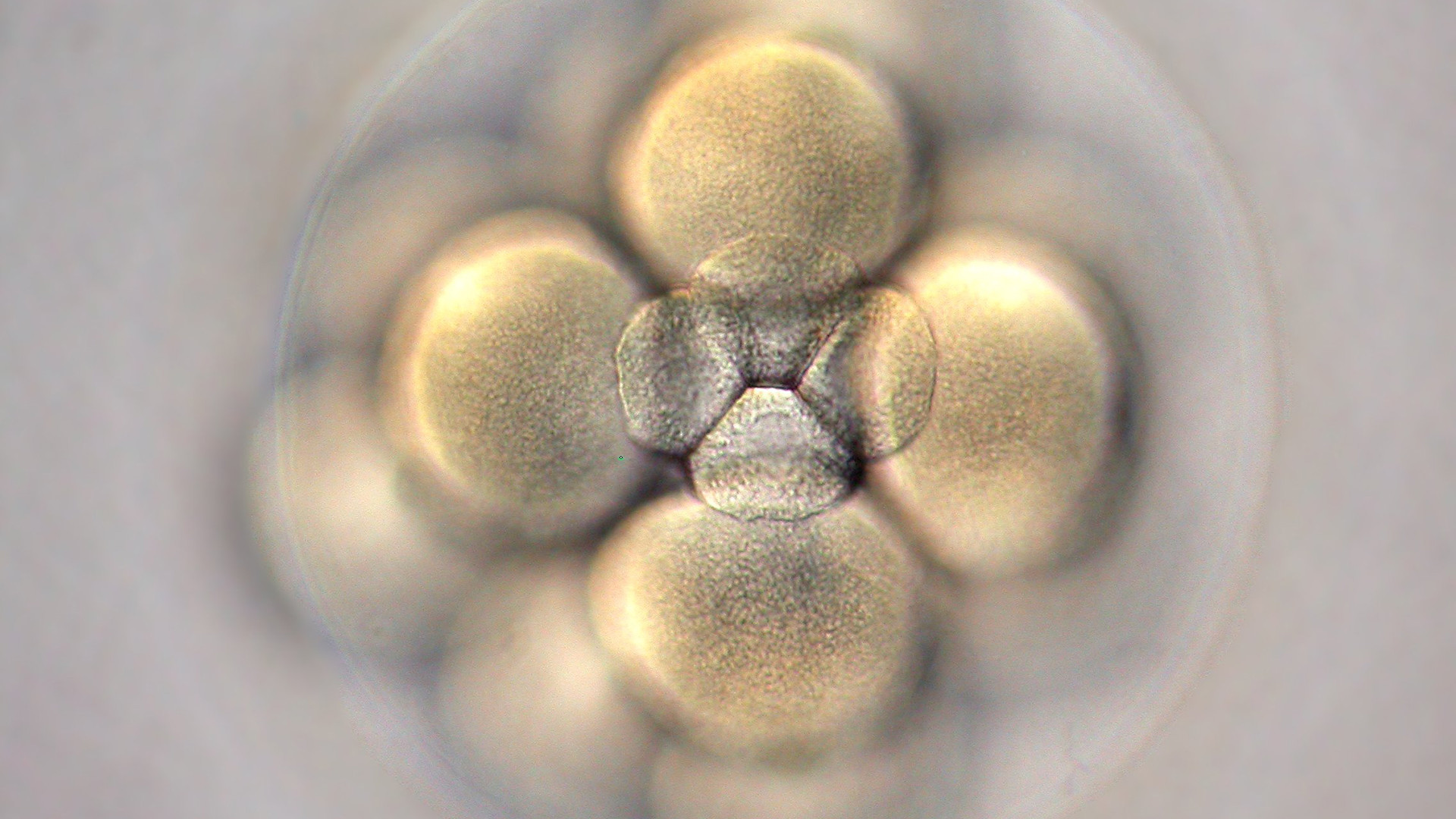 "Qu’est-ce qu’un embryon? Un ensemble de cellules vivantes ou une personne humaine qui se développe?" (Photo: flickr/nelas/CC BY-SA 2.0)