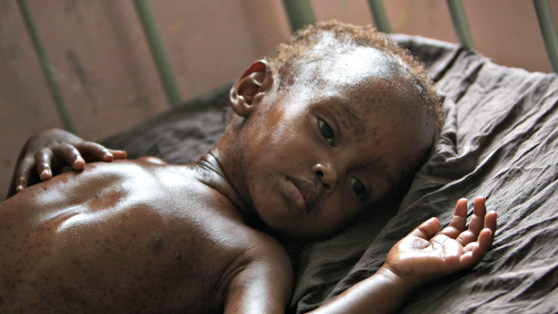 De nombreux enfants du Sud souffrent de la faim (Photo:UN Photos/Flickr/CC BY-NC-ND 2.0)