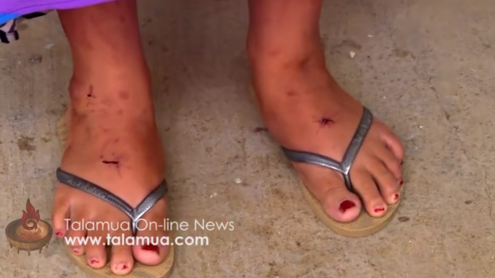 Les pieds de la Samoane Toaipuapuaga Opapo Soana’i, qui affirme avoir reçu les stigmates (capture d'écran:YouTube)