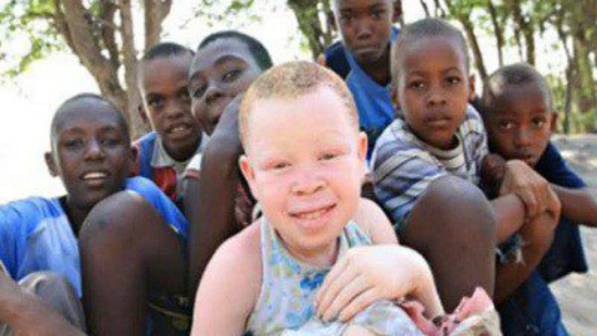 Enfant albinos (Photo:  twitter.com Asambiz)