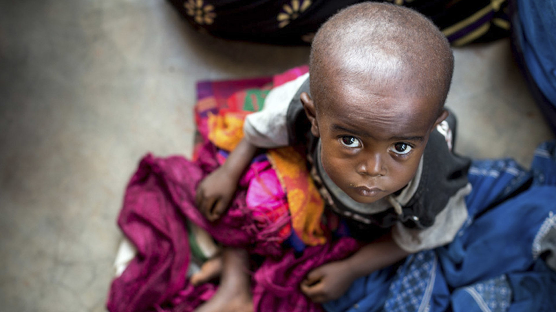 Un enfant souffrant de malnutrition attend un traitement dans un centre de santé dans la province du Kasaï oriental en RDC. | © UNICEF