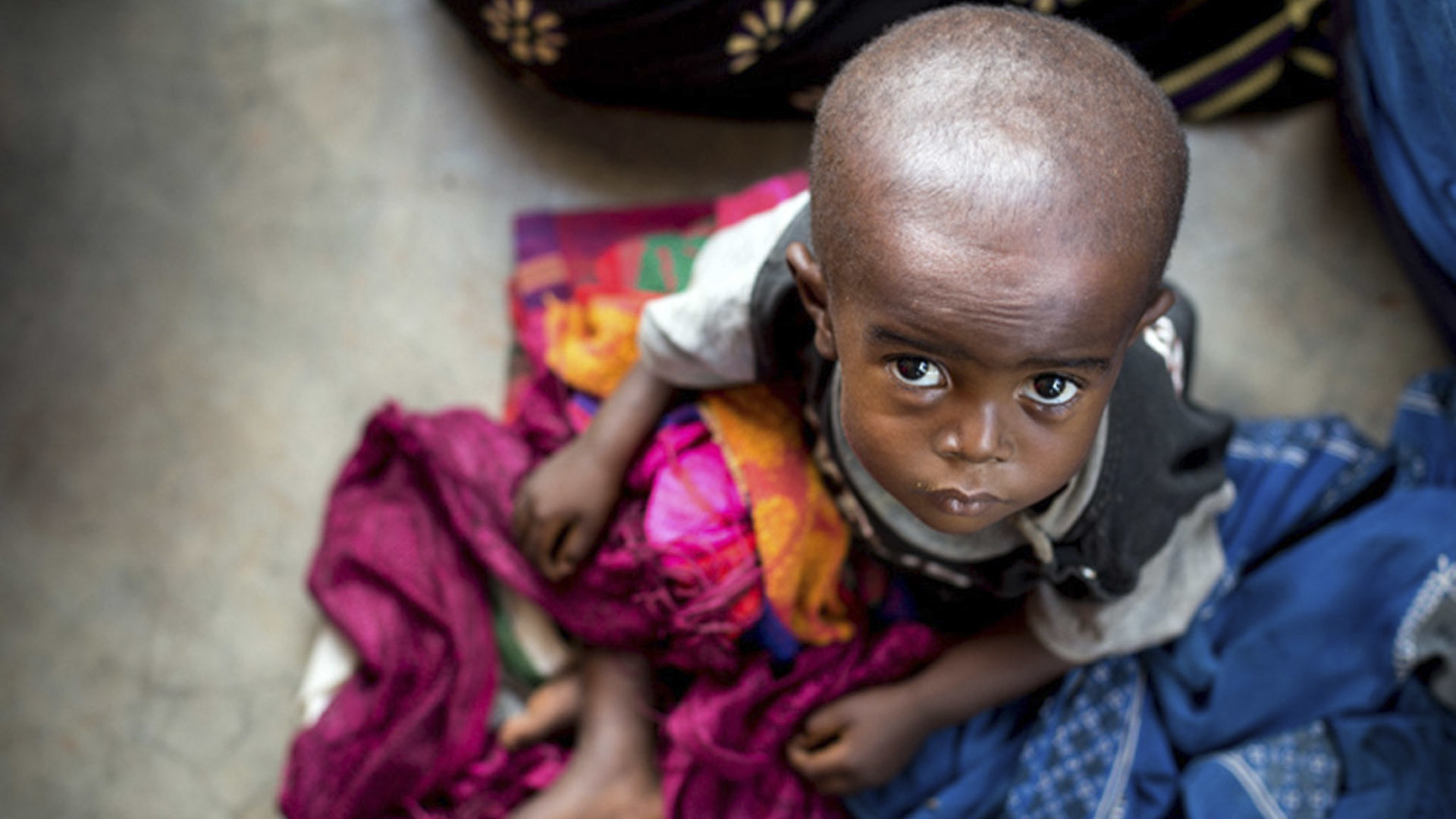 Quoi de plus obscène, finalement, que des enfants qui meurent de faim? | © ONU