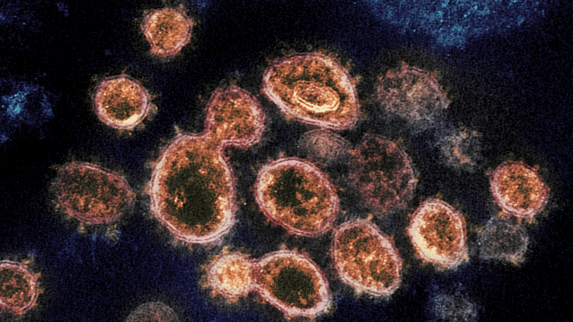 Souche de coronavirus sous le microscope | domaine public