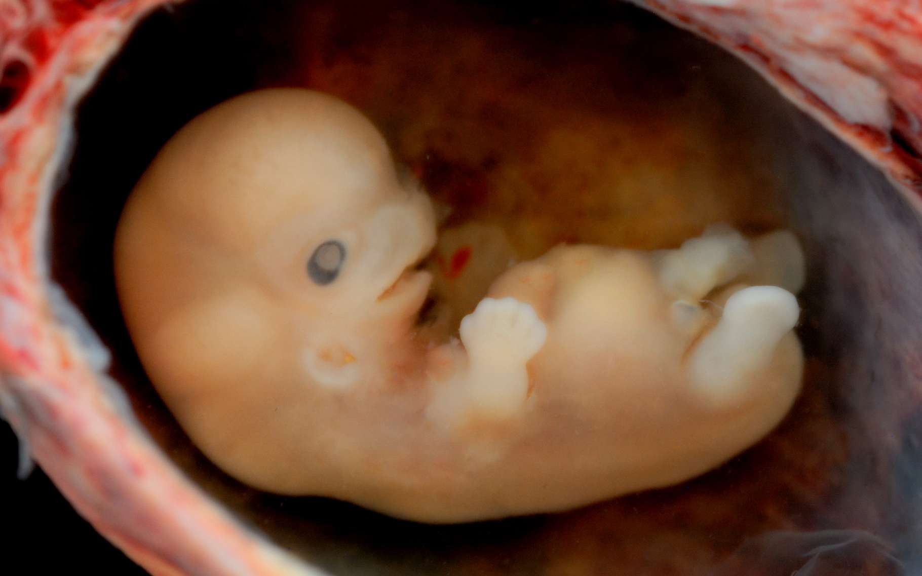 Un foetus à l'âge de huit semaines | DR