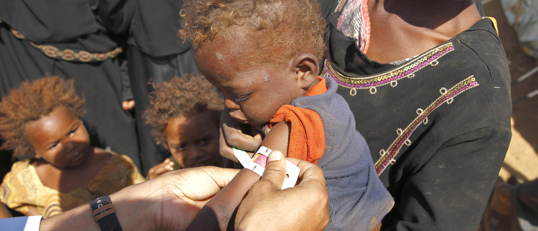 Une grande partie de la population yéménite souffre de malnutrition | © photo d'illustration (2009) IRIN/Flickr/CC BY-NC-ND 2.0
